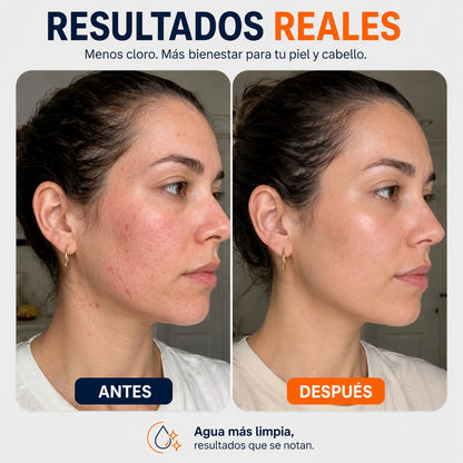 🚿 Alcachofa De Ducha Filtrante Premium™ | Salva Tu Piel, Tu Pelo y Tu Salud✨